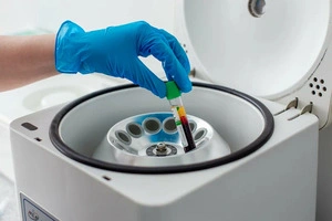 Plazmolifting — PRP terapiya